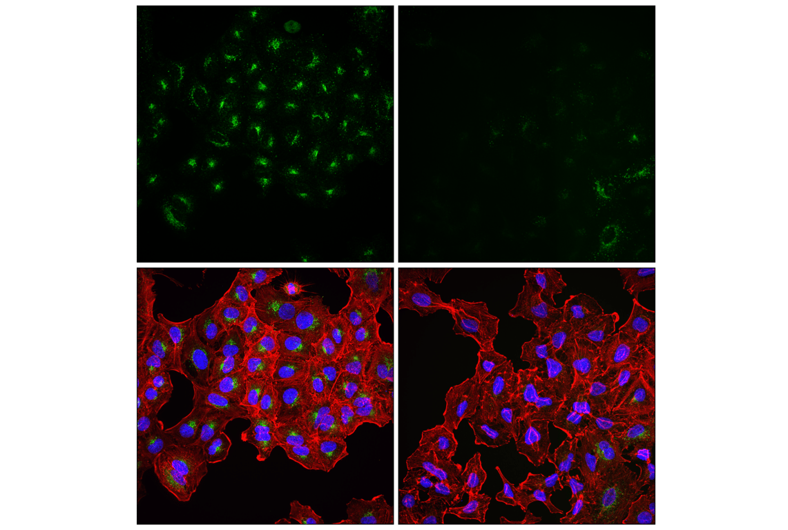 Immunofluorescence Image 1: APP (E4H1U) Rabbit mAb