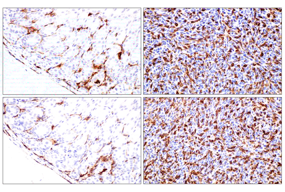 Immunohistochemistry Image 10: CD11b/ITGAM (E4K8C) Rabbit mAb
