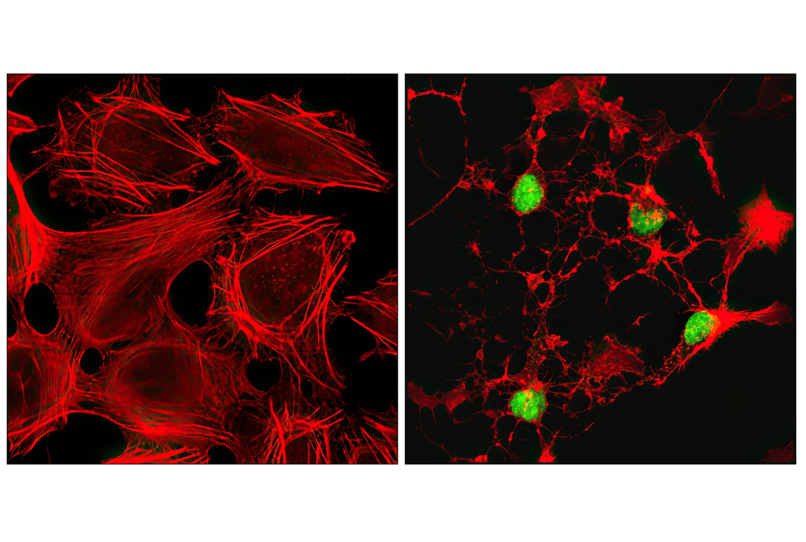 Immunofluorescence Image 1: Cleaved PARP (Asp214) (D64E10) XP® Rabbit mAb (Alexa Fluor® 488 Conjugate)