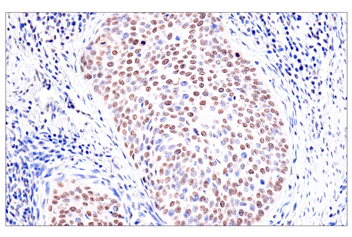 Immunohistochemistry Image 2: FoxA1/HNF3α (IHC578) Mouse mAb