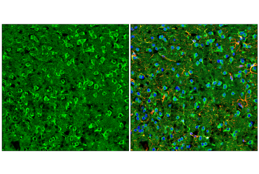 undefined Image 8: Late-Onset Alzheimer's Disease Risk Gene (Mouse Model) Antibody Sampler Kit
