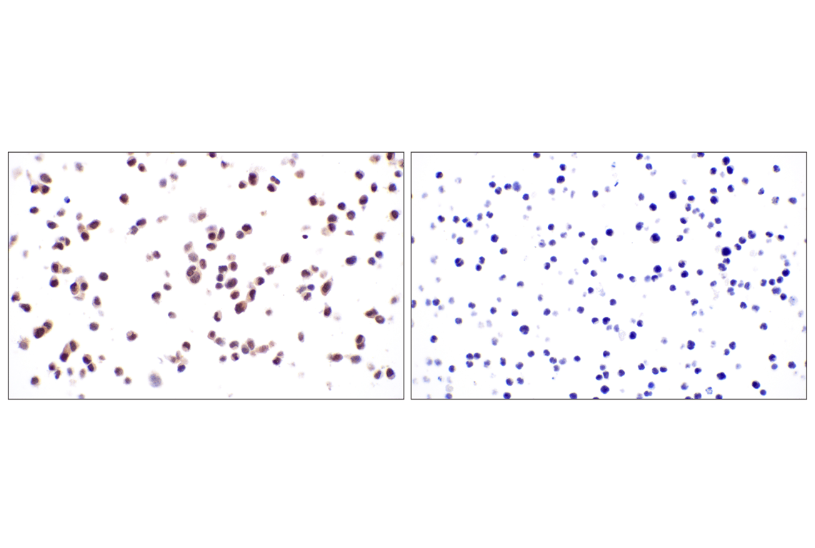 Immunohistochemistry Image 9: ID1 (F2M1J) Rabbit mAb (BSA and Azide Free)