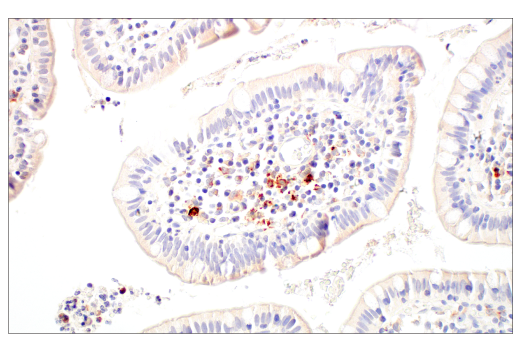 Immunohistochemistry Image 9: LAMP3/CD208 (E6E5U) XP<sup>®</sup> Rabbit mAb (BSA and Azide Free)