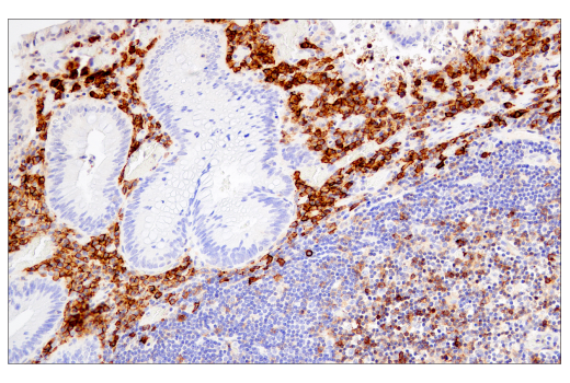 Immunohistochemistry Image 2: CD38 (E7Z8C) XP<sup>®</sup> Rabbit mAb (BSA and Azide Free)