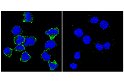 Immunofluorescence Image 1: CD96 (E1Y2Z) Rabbit mAb