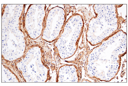 Immunohistochemistry Image 7: CD141/Thrombomodulin (E7Y9P) XP<sup>®</sup> Rabbit mAb