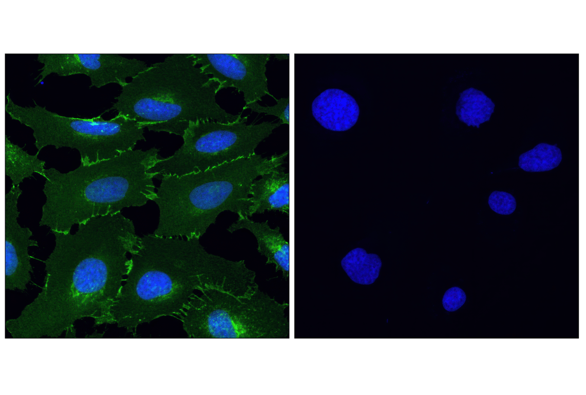 Immunofluorescence Image 1: β-Catenin (D10A8) XP<sup>®</sup> Rabbit mAb (BSA and Azide Free)