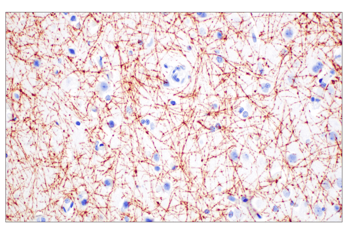 undefined Image 26: Demyelinating Disease Targets Antibody Sampler Kit
