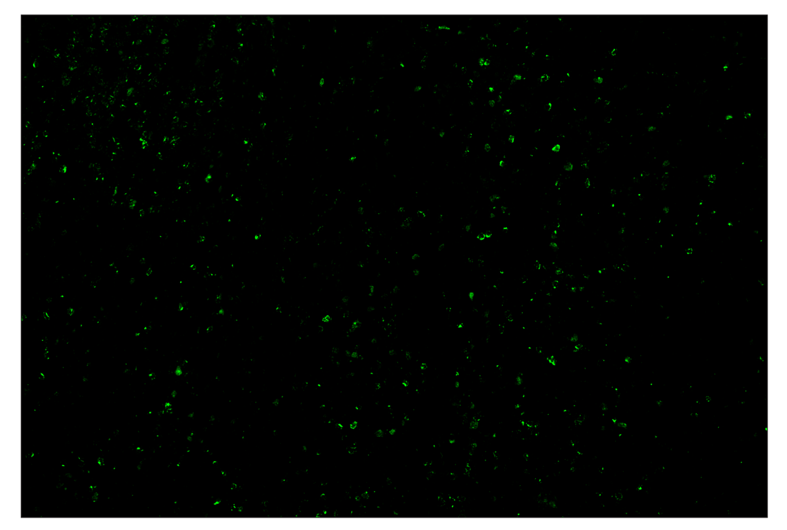 Immunohistochemistry Image 2: CTLA-4 (E2V1Z) & CO-0078-488 SignalStar<sup>™</sup> Oligo-Antibody Pair