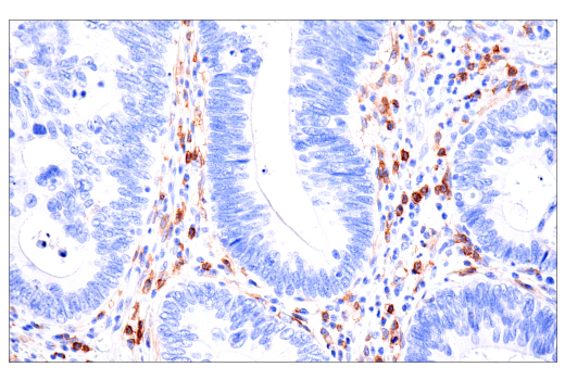 Immunohistochemistry Image 1: CD4 (EP204) Rabbit mAb