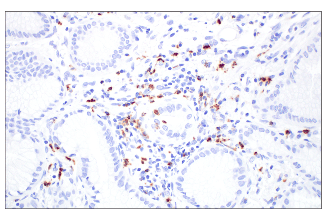 Immunohistochemistry Image 3: NKG7 (F4V5I) Rabbit mAb (BSA and Azide Free)