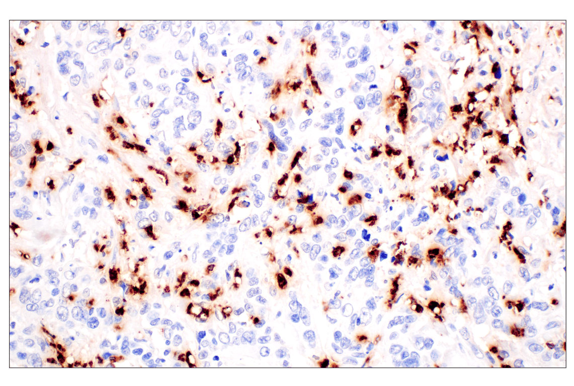 Immunohistochemistry Image 4: Neutrophil Elastase (F4H3X) Rabbit mAb (BSA and Azide Free)