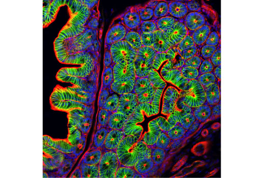 Immunofluorescence Image 1: Non-phospho (Active) β-Catenin (Ser45) (D2U8Y) XP<sup>®</sup> Rabbit mAb (BSA and Azide Free)