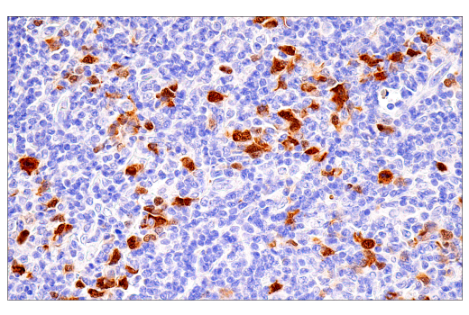 Immunohistochemistry Image 4: Cyclin A2 (E6D1J) XP<sup>®</sup> Rabbit mAb