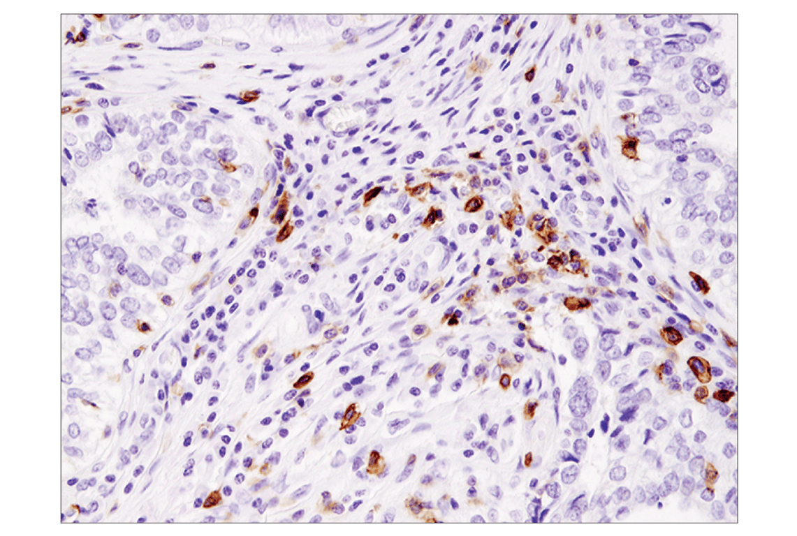 Immunohistochemistry Image 2: ICOS (D1K2T<sup>™</sup>) Rabbit mAb (BSA and Azide Free)