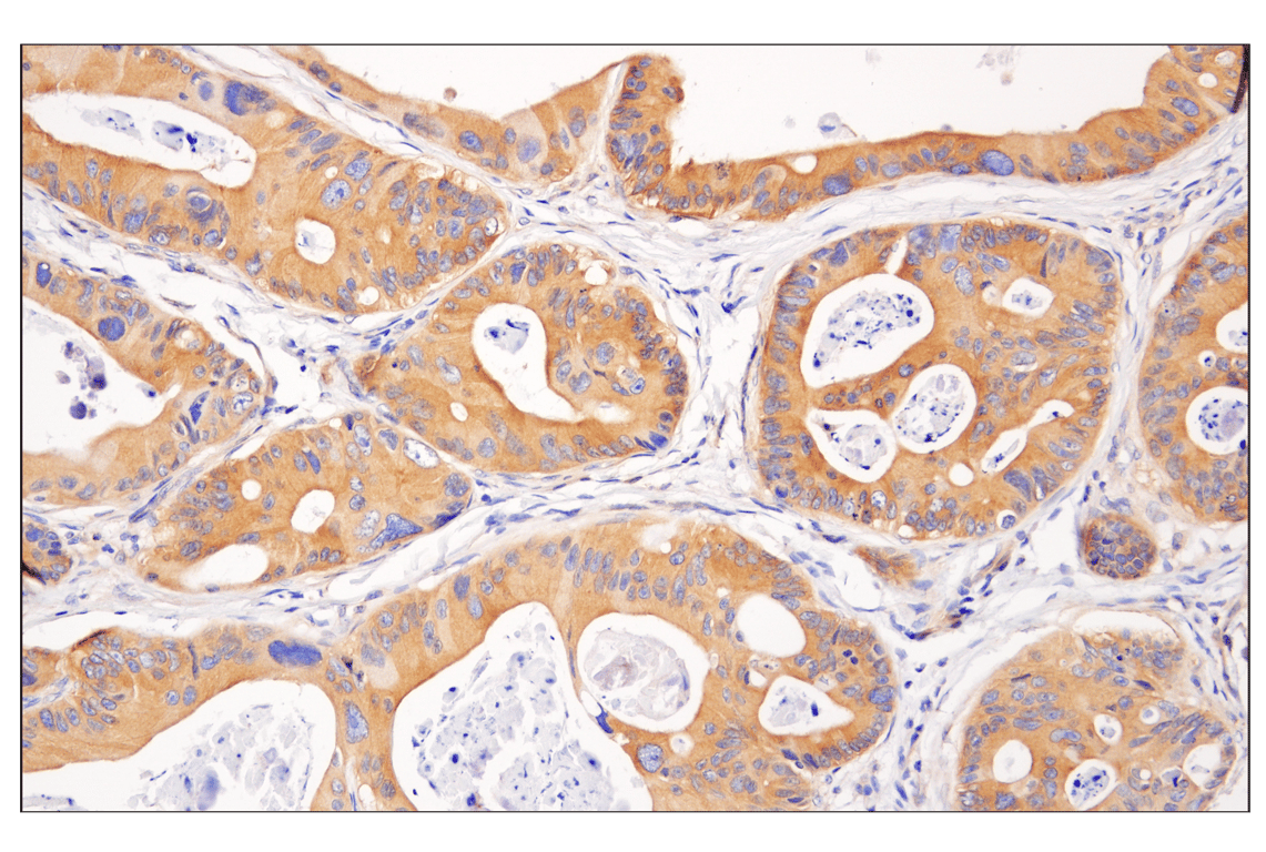 undefined Image 5: PhosphoPlus<sup>®</sup> AMPKα (Thr172) Antibody Duet