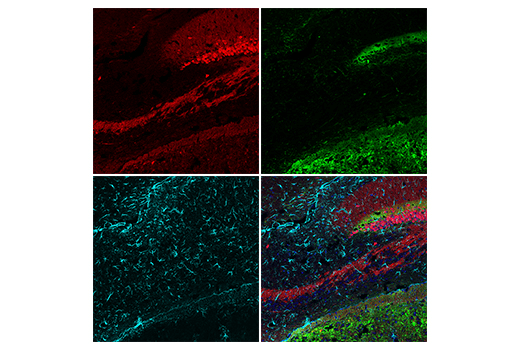 Immunofluorescence Image 3: Calretinin (E7R6O) XP<sup>®</sup> Rabbit mAb