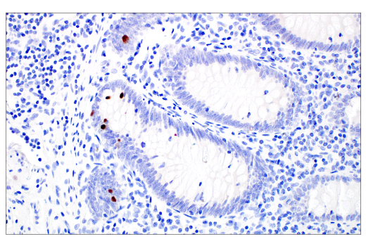 Immunohistochemistry Image 6: POU2F3 (E5N2D) XP<sup>®</sup> Rabbit mAb