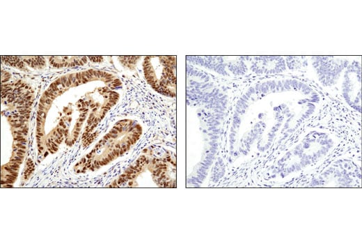 undefined Image 11: Ubiquitin E3 Ligase Complex Antibody Sampler Kit