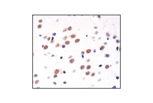 undefined Image 65: Cannabinoid Receptor 1 Downstream Signaling Antibody Sampler Kit