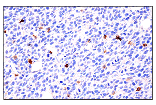 Immunohistochemistry Image 4: IL-2Rα/CD25 (E4B2Z) XP<sup>®</sup> Rabbit mAb (BSA and Azide Free)