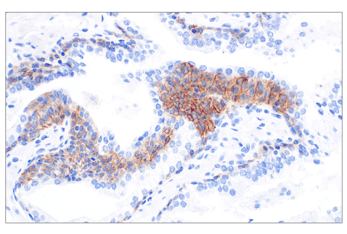 Immunohistochemistry Image 6: CD44 v5 (C44Mab-3) Mouse mAb