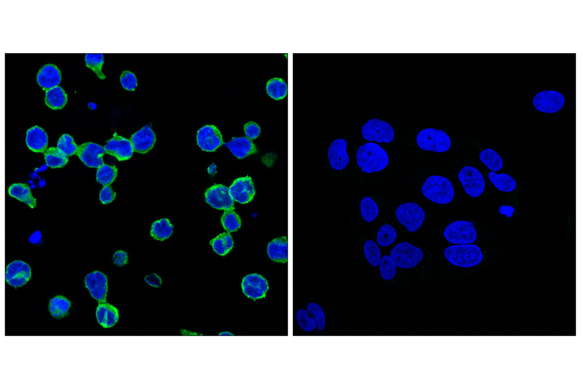 Immunofluorescence Image 1: SHIP1 (C40G9) Rabbit mAb (BSA and Azide Free)