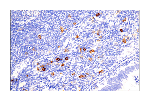 Immunohistochemistry Image 2: TNFRSF8/CD30 (E7E4D) XP<sup>®</sup> Rabbit mAb (BSA and Azide Free)