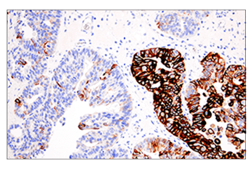 Immunohistochemistry Image 3: Keratin 5 (E2T4B) XP<sup>®</sup> Rabbit mAb