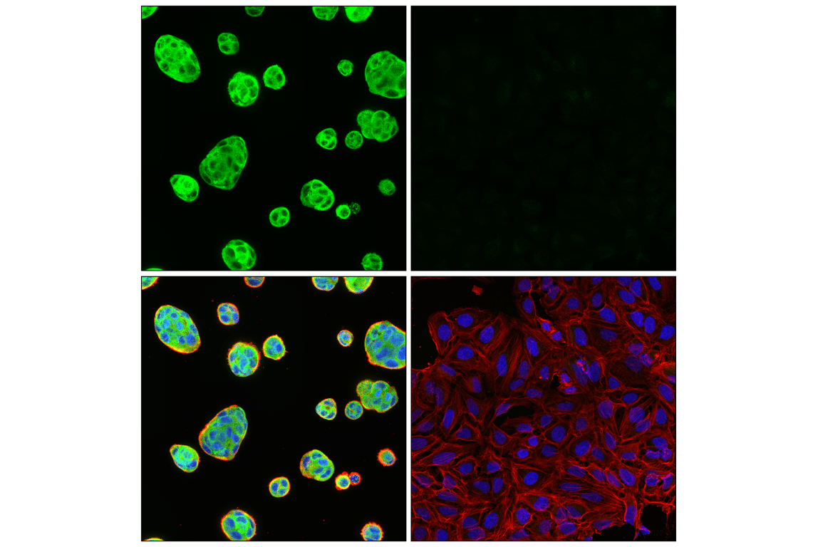 Immunofluorescence Image 1: VAPB (E7R3Z) Rabbit mAb