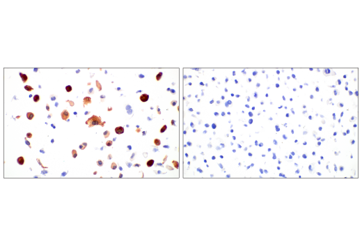 Immunohistochemistry Image 3: SARS-CoV-2 Nucleocapsid Protein (E8R1L) Mouse mAb