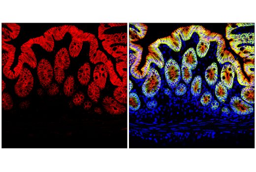 Immunofluorescence Image 1: β-Catenin (D10A8) XP<sup>®</sup> Rabbit mAb (Alexa Fluor<sup>®</sup> 555 Conjugate)