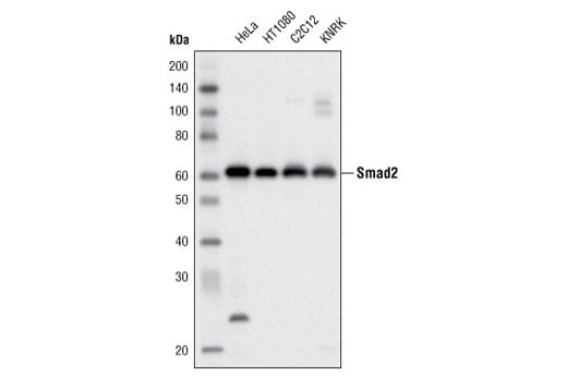 Western Blotting Image 2: Smad2 (D43B4) XP<sup>®</sup> Rabbit mAb (BSA and Azide Free)