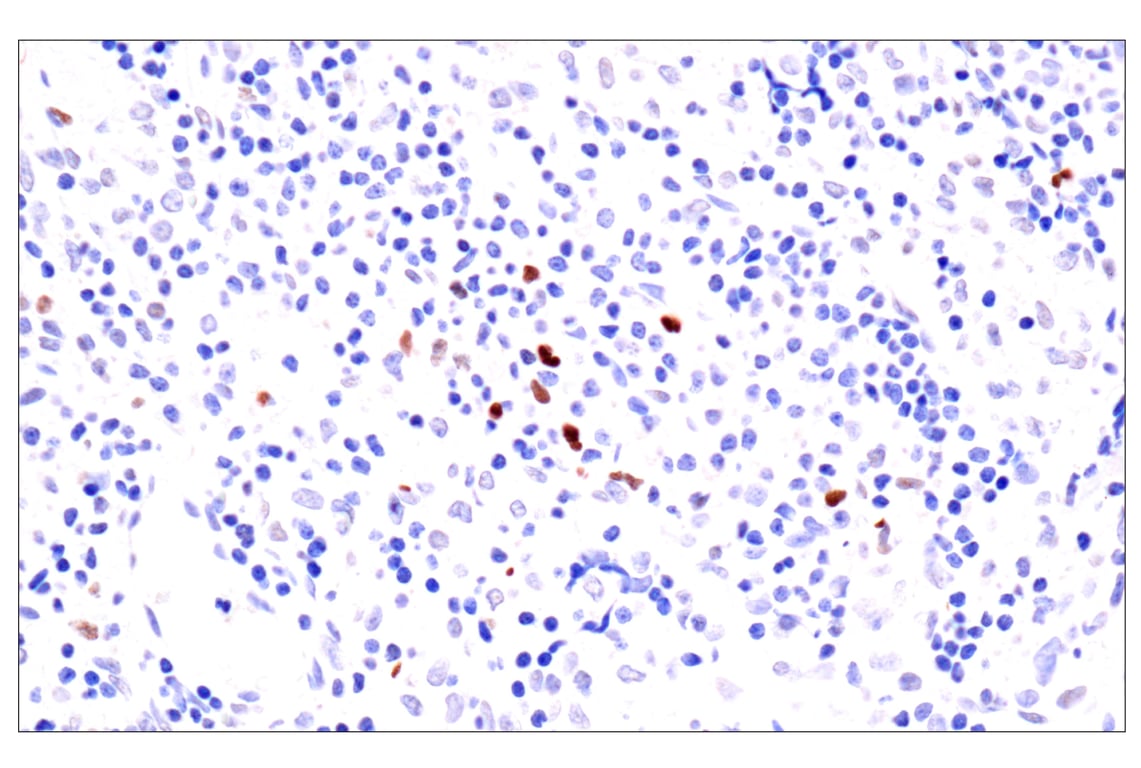 Immunohistochemistry Image 8: BATF3 (E3F3L) Rabbit mAb