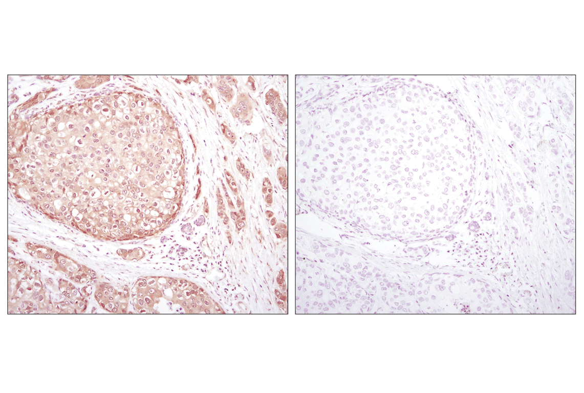 Immunohistochemistry Image 2: Akt (pan) (C67E7) Rabbit mAb
