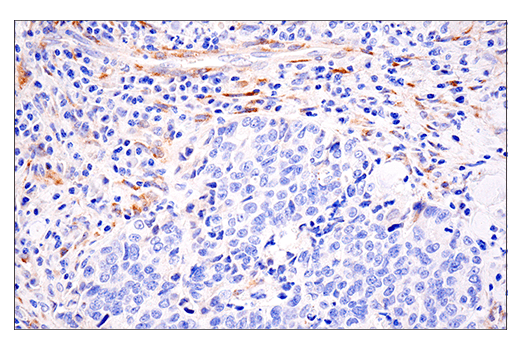 Immunohistochemistry Image 3: LOXL2 (E3P7Y) Rabbit mAb (BSA and Azide Free)