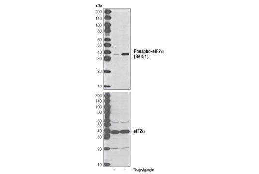 Western Blotting Image 1: Phospho-eIF2α (Ser51) (D9G8) XP® Rabbit mAb (BSA and Azide Free)