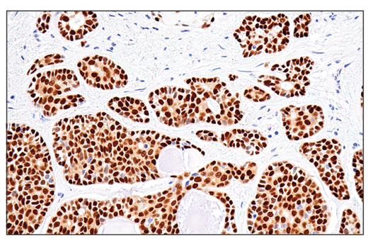 Immunohistochemistry Image 2: Sox10 (E6B6I) XP<sup>®</sup> Rabbit mAb (BSA and Azide Free)