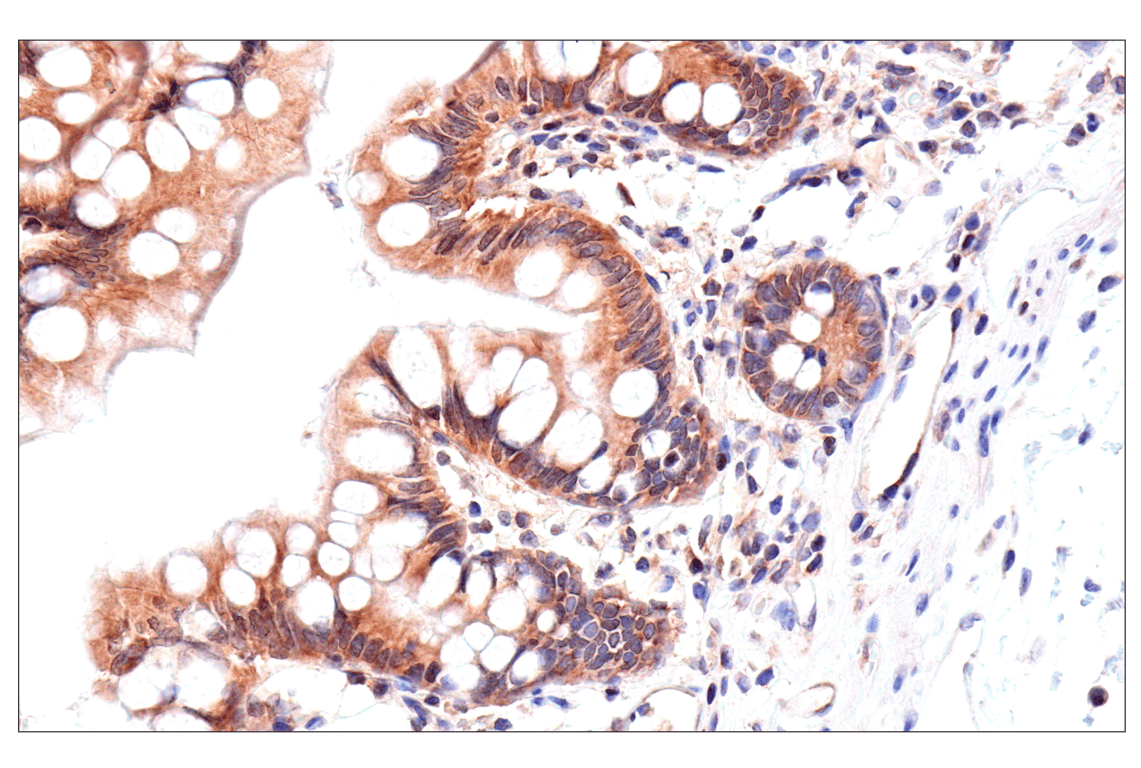 Immunohistochemistry Image 9: ADAR1 p150 Isoform (E6U1U) Rabbit mAb