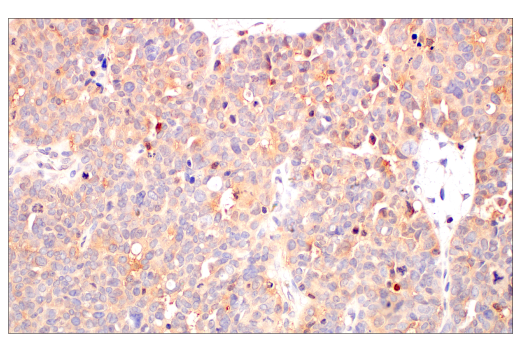 Immunohistochemistry Image 4: c-Rel (E8Z5Y) XP<sup>®</sup> Rabbit mAb (BSA and Azide Free)