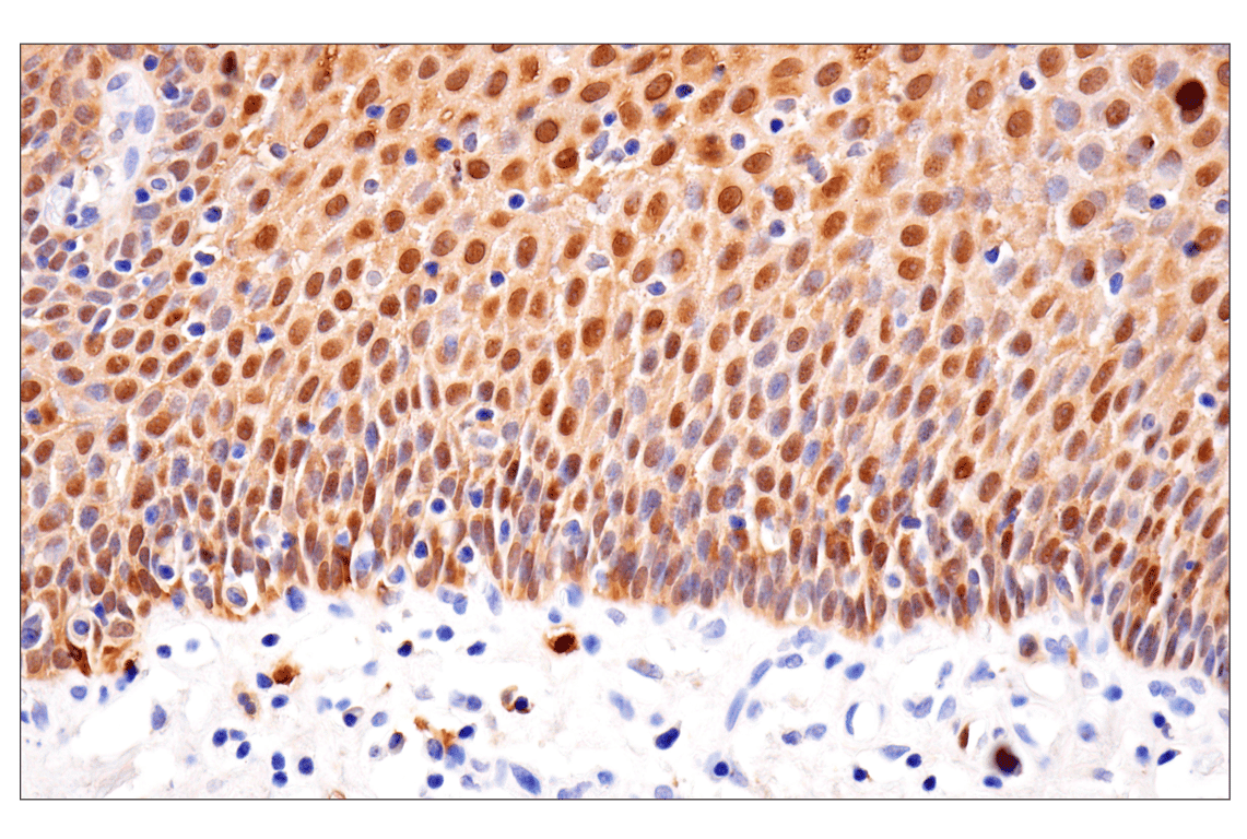 Immunohistochemistry Image 8: S100A8 (F4R2W) Rabbit mAb (BSA and Azide Free)