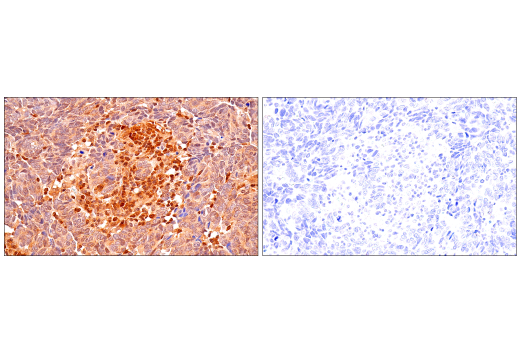 Immunohistochemistry Image 13: p70 S6 Kinase (E8K6T) XP<sup>®</sup> Rabbit mAb