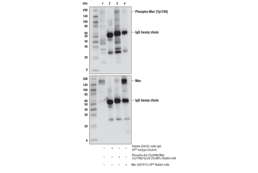 Immunoprecipitation Image 2: Phospho-Axl (Tyr698)/Mer (Tyr749)/Tyro3 (Tyr681) (D6M4W) Rabbit mAb