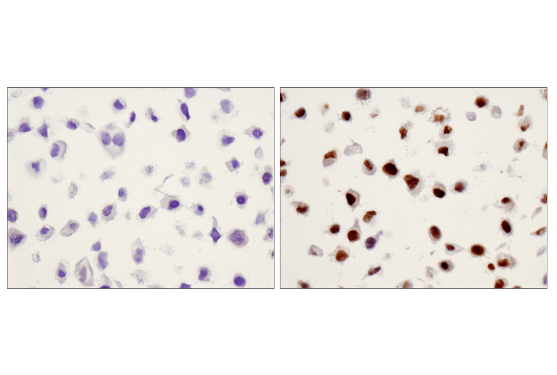 undefined Image 49: ALK Activation Antibody Sampler Kit
