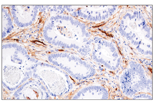 Immunohistochemistry Image 1: CD141/Thrombomodulin (E7Y9P) XP<sup>®</sup> Rabbit mAb