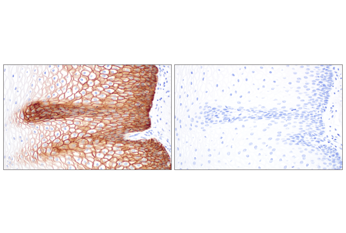 Immunohistochemistry Image 10: CD44 v5 (C44Mab-3) Mouse mAb