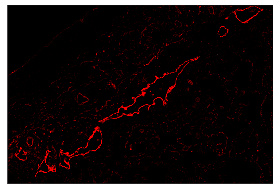 Immunohistochemistry Image 4: NT5E/CD73 (D7F9A) & CO-0039-750 SignalStar<sup>™</sup> Oligo-Antibody Pair