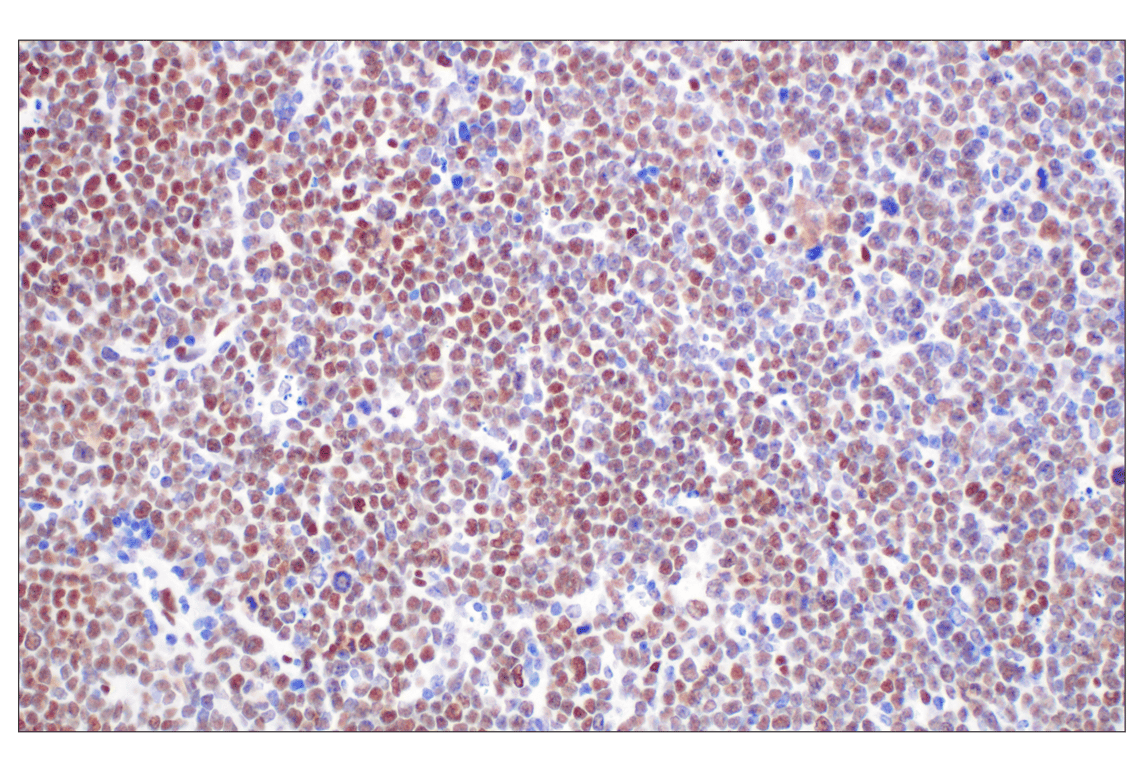 Immunohistochemistry Image 2: TCF4/ITF2 (E3X2Y) Rabbit mAb