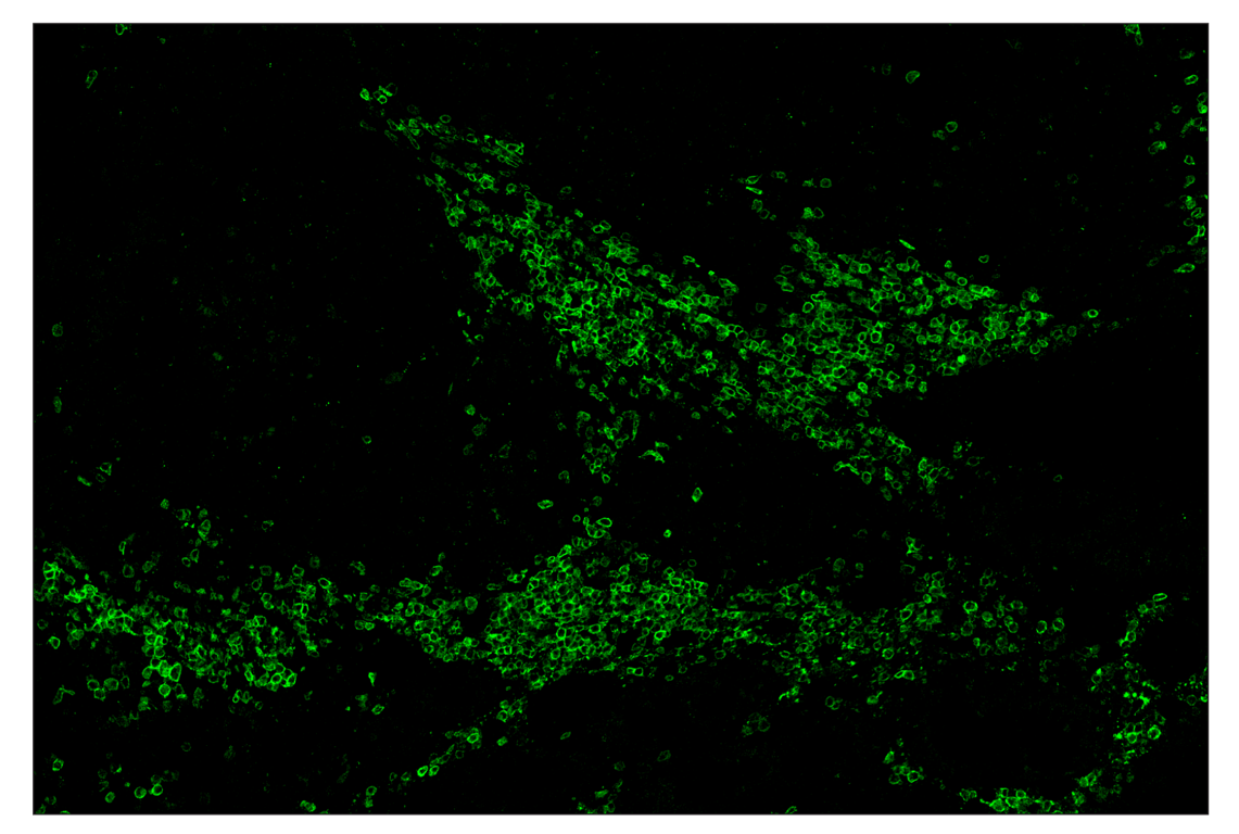 Immunohistochemistry Image 1: CD19 (Intracellular Domain) (D4V4B) & CO-0054-594 SignalStar<sup>™</sup> Oligo-Antibody Pair