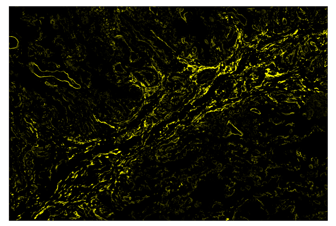 Immunohistochemistry Image 3: NT5E/CD73 (D7F9A) & CO-0039-750 SignalStar<sup>™</sup> Oligo-Antibody Pair